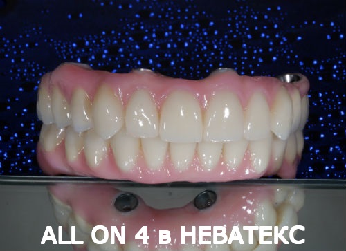 олл он фо протез верх и низ