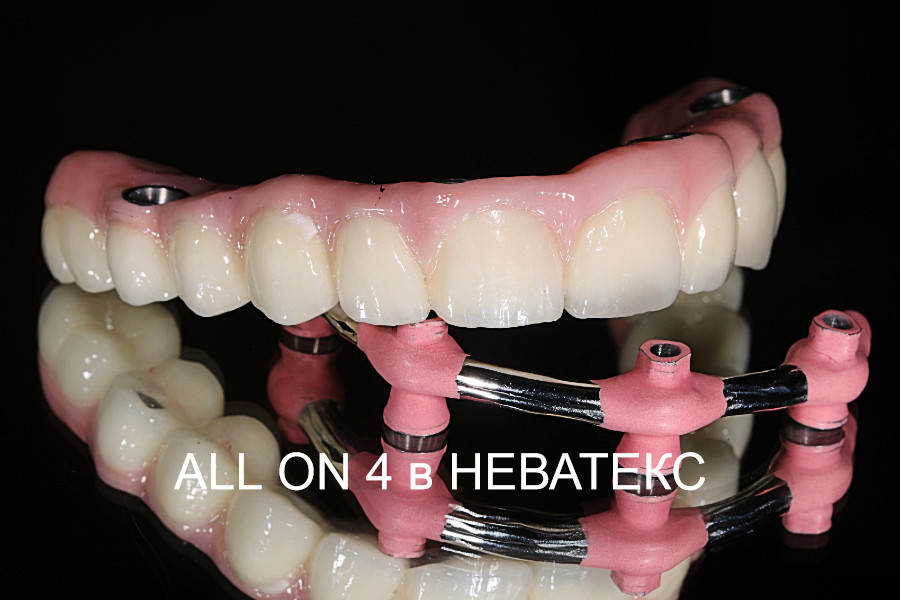 фото зубов all on 4