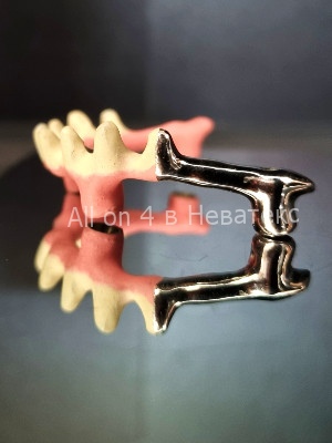 дуга-гребенка для протеза all on 4