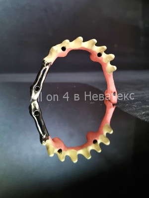 балка - основа керамокомпозито-наполненного протеза