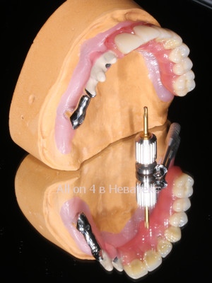 балка-гребенка на модели