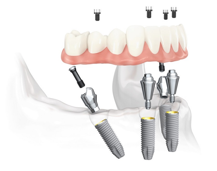 all on 4 картинки