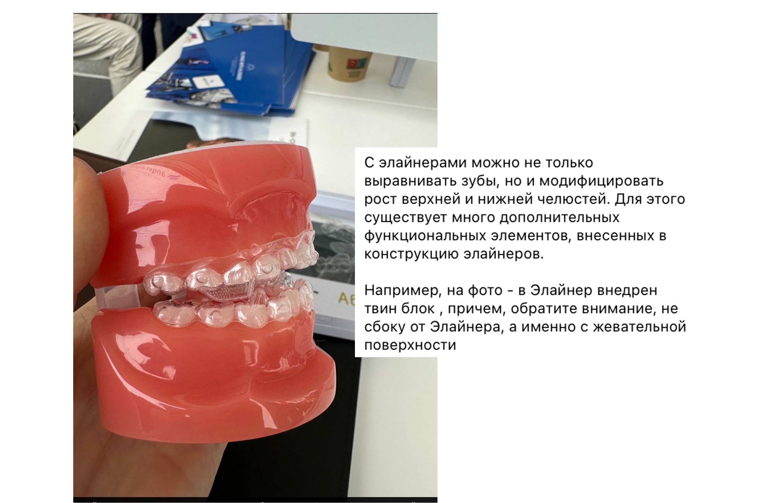 улыбка до и после-20
